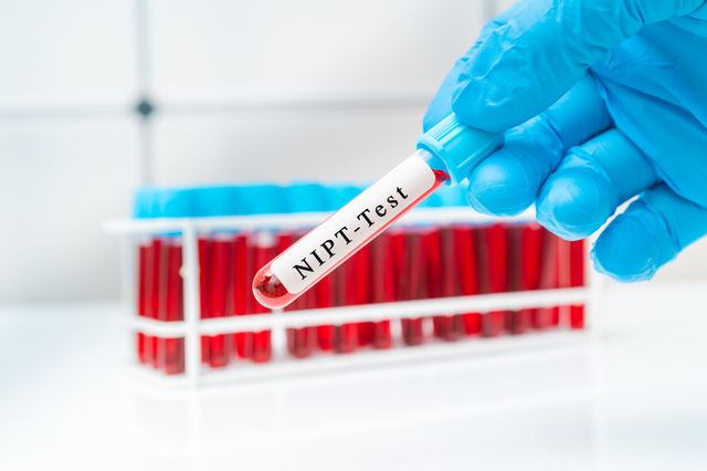 新型出生前診断(NIPT)の精度を表す指標とは 年齢も関係している?
