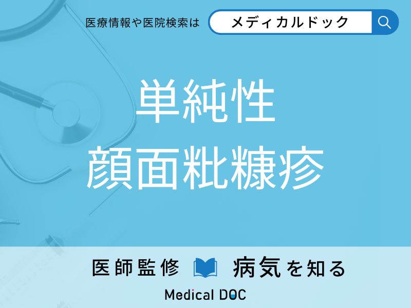 単純性顔面粃糠疹