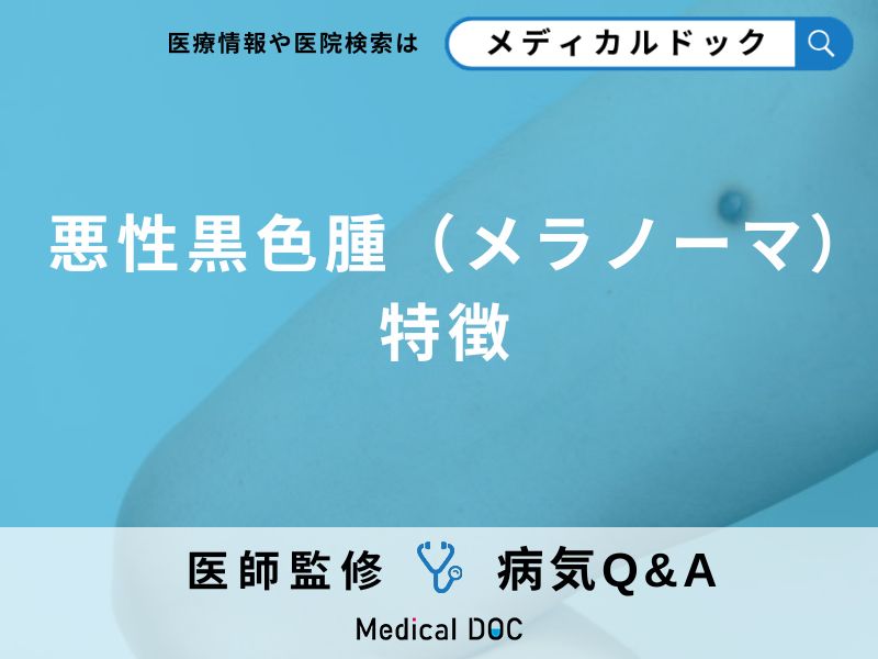 「悪性黒色種（メラノーマ）」の初期症状・原因はご存知ですか？【医師監修】