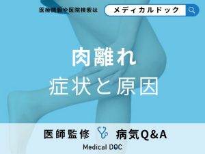 肉離れの症状と原因